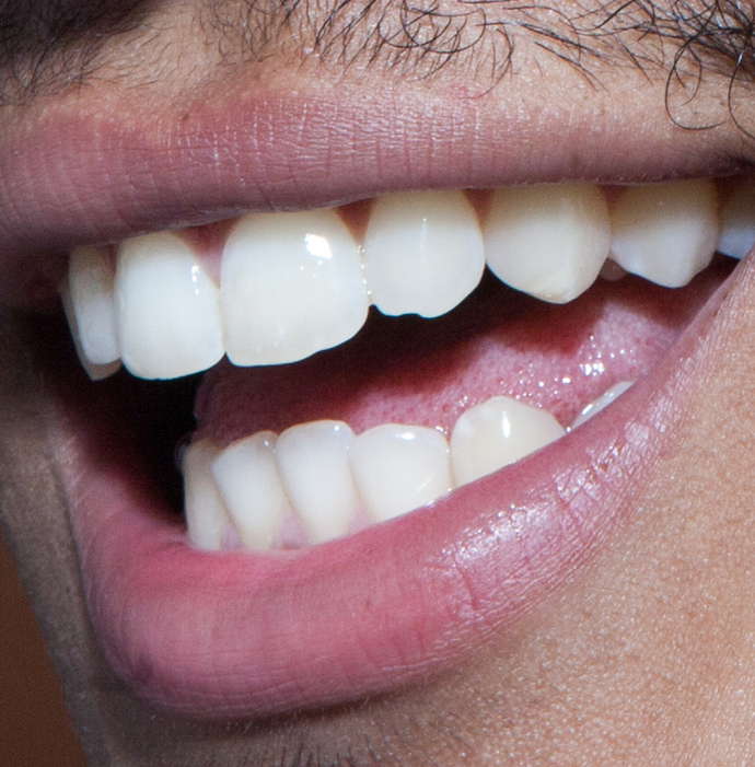 Smile